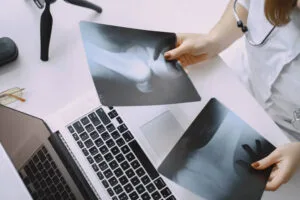 icd-10 code for right knee pain
